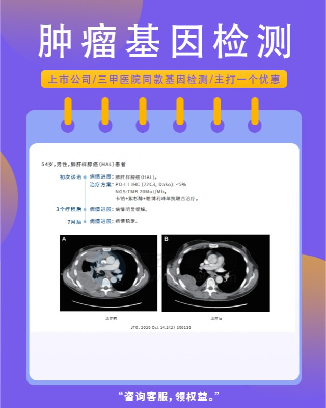 上海肿瘤基因检测需要多长时间出结果